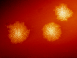 Clostridium_difficile_01